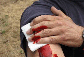 Accident Exampble With Blood